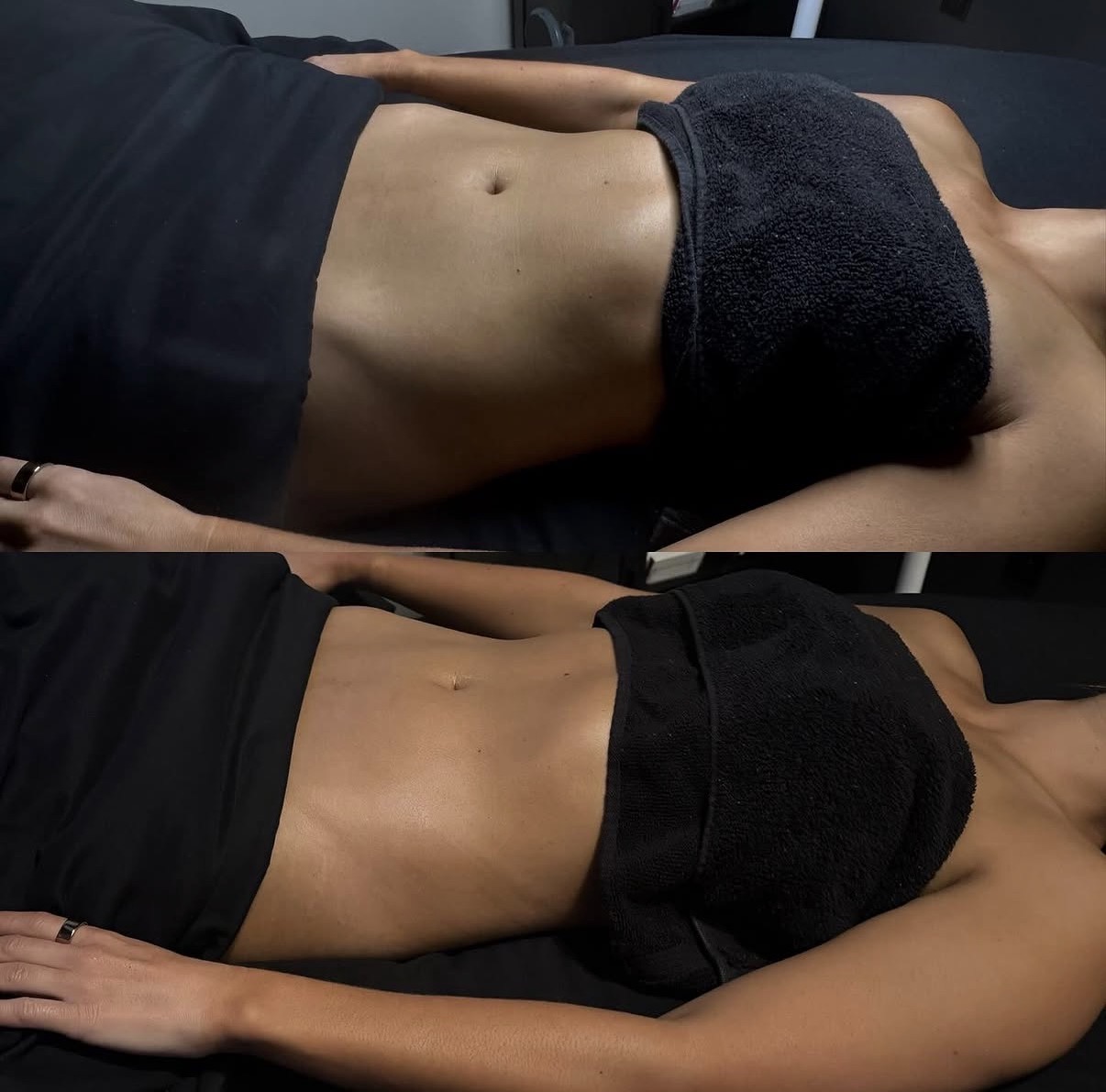 Client before and after a lymphatic drainage session