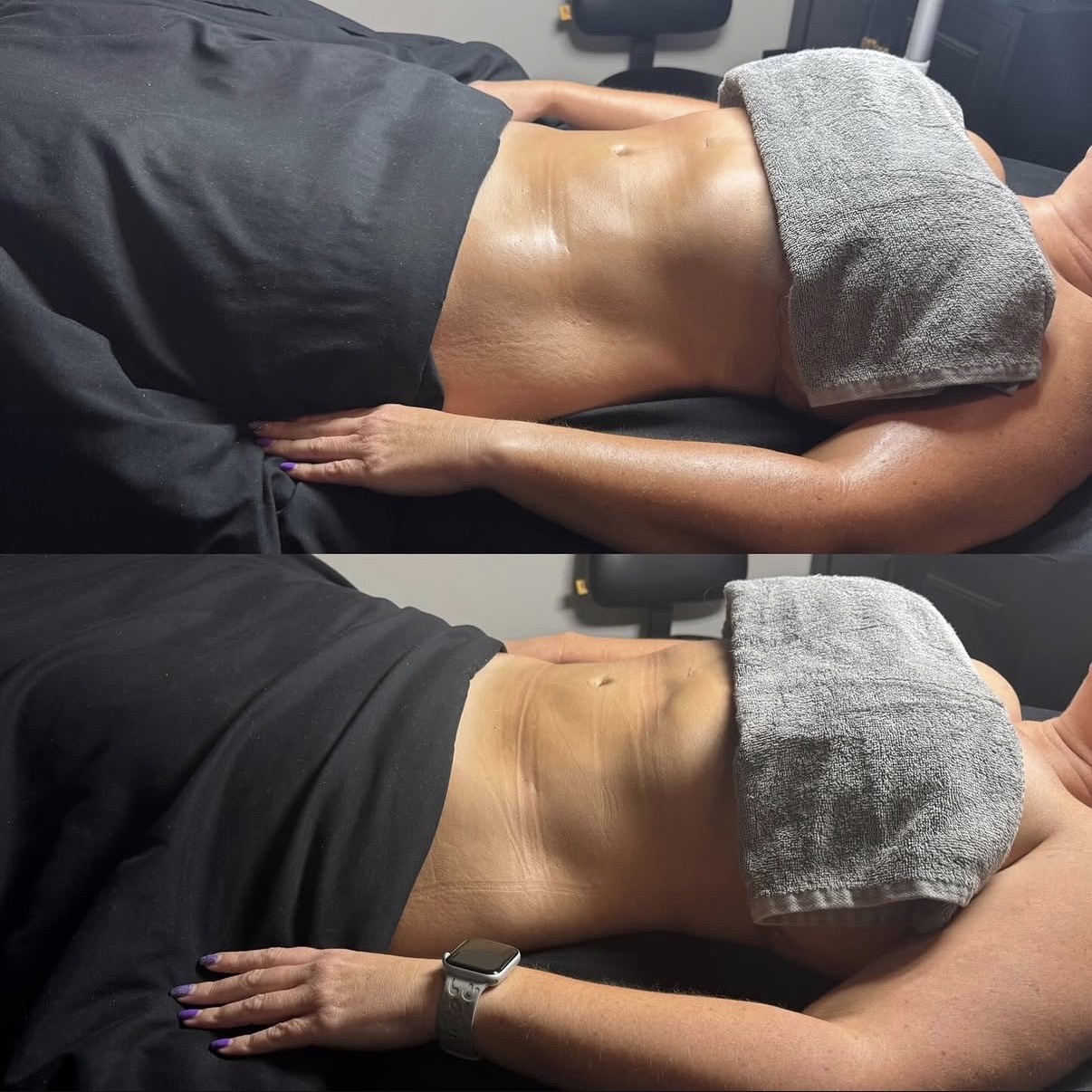Client before and after a lymphatic drainage session